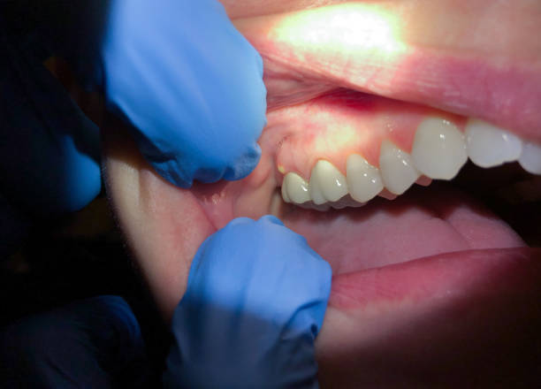 Best Orthodontic Emergency Dentist in Fortuna Foothills, AZ